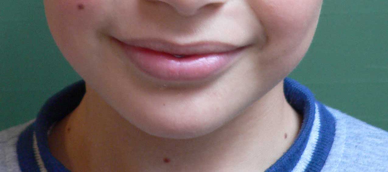 image du bas