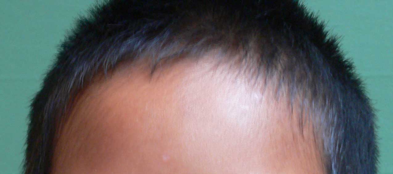 image du haut